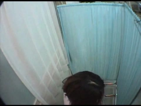 美容整形。豊胸手術前の診察①