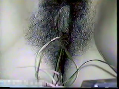 美容整形のカルテ動画流出 3